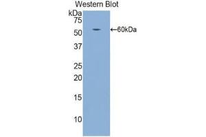 Western Blotting (WB) image for anti-Integrin beta 1 (ITGB1) (AA 140-383) antibody (ABIN1174146) (ITGB1 抗体  (AA 140-383))