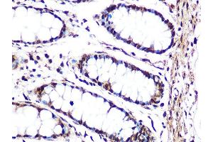 Immunohistochemistry of paraffin-embedded human colon using JNK1/JNK3 Rabbit mAb (ABIN1678909, ABIN7101754, ABIN7101755 and ABIN7101756) at dilution of 1:100 (40x lens). (JNK 抗体)