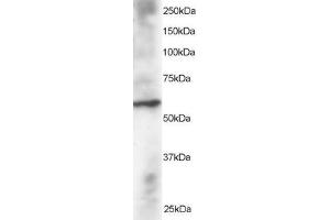 Western Blotting (WB) image for anti-Dual Specificity Phosphatase 8 (DUSP8) (N-Term) antibody (ABIN2465625) (DUSP8 抗体  (N-Term))