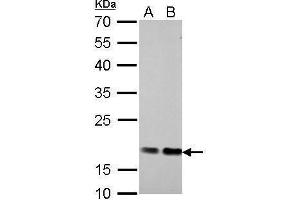WB Image Cofilin 1 antibody detects CFL1 protein by Western blot analysis. (Cofilin 抗体)
