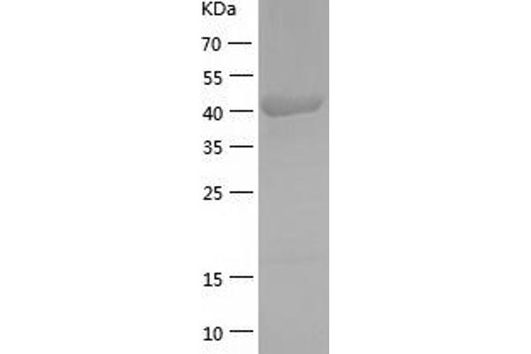 ACADSB Protein (AA 34-432) (His tag)