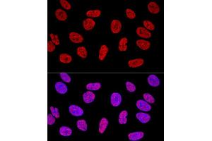 Immunofluorescence (IF) image for anti-KH Domain Containing, RNA Binding, Signal Transduction Associated 1 (KHDRBS1) (C-Term) antibody (ABIN6142829)