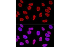 Confocal immunofluorescence analysis of U2OS cells using KHDRBS1/Sam68 Polyclonal Antibody (ABIN6133782, ABIN6142829, ABIN6142830 and ABIN6221707) at dilution of 1:400. (KHDRBS1 抗体  (C-Term))