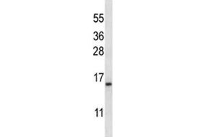 BAFF antibody western blot analysis in K562 lysate. (TNFRSF13C 抗体  (AA 1-30))