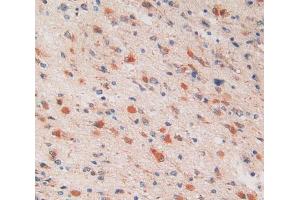 Used in DAB staining on fromalin fixed paraffin- embedded glioma tissue