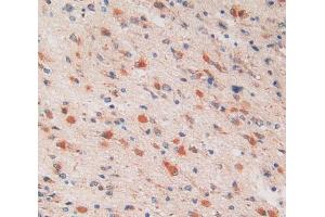 Used in DAB staining on fromalin fixed paraffin- embedded glioma tissue (PSMC6 抗体  (AA 2-403))