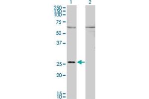 Western Blot analysis of GAP43 expression in transfected 293T cell line by GAP43 monoclonal antibody (M01), clone 3C11. (GAP43 抗体  (AA 1-238))
