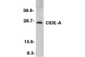 Image no. 1 for anti-Cell Death-Inducing DFFA-Like Effector A (CIDEA) (AA 200-214) antibody (ABIN201945)