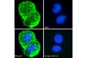 Immunofluorescence staining of fixed MCF7 cells with anti-Breast epithelial mucin antibody Mc5. (Recombinant MUC1 抗体)