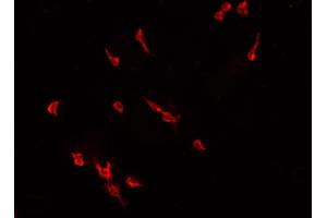 ABIN6266812 staining CACO-2 cells by IF/ICC. (ELF1 抗体  (C-Term))