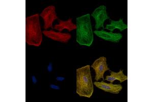 ABIN6258510 and ABIN6274721 staining  cells by IF/ICC.