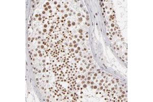 Immunohistochemical staining of human testis with INTS6 polyclonal antibody  shows cytoplasmic positivity in trophoblastic cells at 1:50-1:200 dilution. (INTS6 抗体)