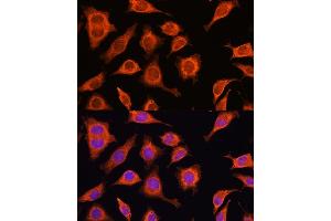 Immunofluorescence analysis of L929 cells using D Rabbit pAb (ABIN6127743, ABIN6139383, ABIN6139384 and ABIN6223348) at dilution of 1:100. (DAAM2 抗体  (AA 1-86))