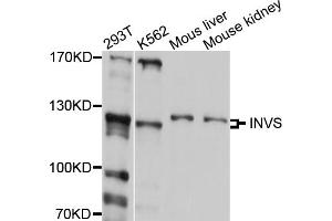 Western blot analysis of extracts of various cell lines, using INVS antibody (ABIN5997996) at 1/1000 dilution. (Inversin 抗体)