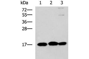 Western blot analysis of 231 HL60 and Jurkat cell lysates using RPS14 Polyclonal Antibody at dilution of 1:700 (RPS14 抗体)