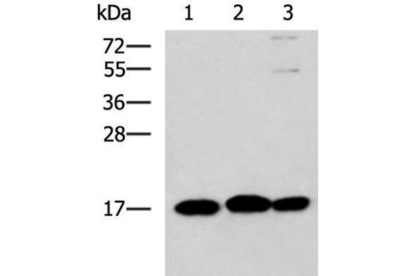 RPS14 anticorps