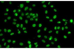 Immunofluorescence analysis of A-549 cells using PMS2 Polyclonal Antibody (PMS2 抗体)