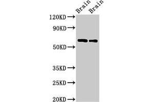 Western Blot Positive WB detected in: Rat brain tissue, Mouse brain tissue All lanes: CPNE4 antibody at 2 μg/mL Secondary Goat polyclonal to rabbit IgG at 1/50000 dilution Predicted band size: 63, 65 kDa Observed band size: 63 kDa (Copine IV 抗体  (AA 1-280))