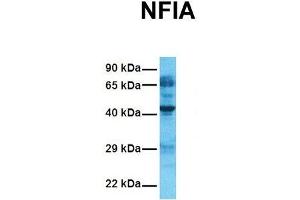 Host:  Rabbit  Target Name:  NFIA  Sample Tissue:  Human Fetal Lung  Antibody Dilution:  1. (NFIA 抗体  (Middle Region))