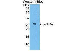 Western Blotting (WB) image for anti-Epiphycan (EPYC) (AA 110-317) antibody (ABIN1858734) (EPYC 抗体  (AA 110-317))