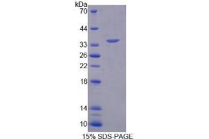 SDS-PAGE analysis of Human ARSF Protein. (ARSF 蛋白)