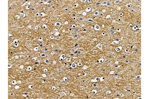 ABIN6257490 and ABIN6275517 at 1/100 staining mouse brain tissue by IHC-P.