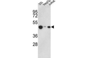 Western Blotting (WB) image for anti-Histone Aminotransferase 1 (HAT1) antibody (ABIN2995847) (HAT1 抗体)