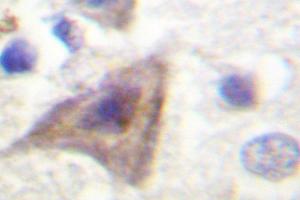 Image no. 1 for anti-AKT1 Substrate 1 (Proline-Rich) (AKT1S1) antibody (ABIN271990) (PRAS40 抗体)