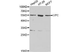 Western blot analysis of extracts of various cell lines, using LIPC antibody (ABIN5970666) at 1/1000 dilution. (LIPC 抗体)