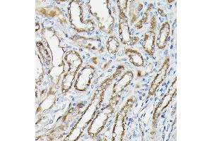 Immunohistochemistry of paraffin-embedded Rat kidney using CALCA antibody (ABIN7266005) at dilution of 1:100 (40x lens). (CGRP 抗体  (AA 1-141))