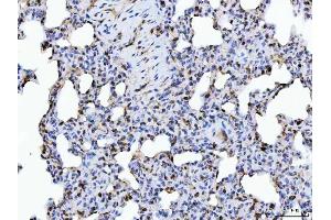 IHC analysis of ERP29 using anti-ERP29 antibody (ABIN7601342). (ERP29 抗体  (AA 33-196))