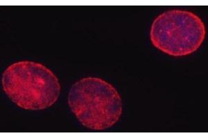 IF analysis of SHQ1 using anti-SHQ1 antibody (ABIN7599205).