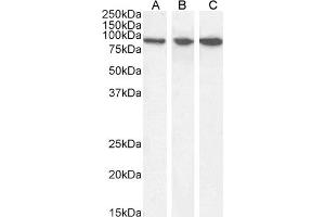 Western Blotting (WB) image for anti-Vacuolar Protein Sorting 35 (VPS35) (C-Term) antibody (ABIN185182)