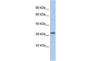 WB Suggested Anti-FGF13 Antibody Titration: 0. (FGF13 抗体  (Middle Region))