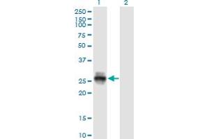 Western Blot analysis of KLK4 expression in transfected 293T cell line by KLK4 monoclonal antibody (M09), clone 2A4. (Kallikrein 4 抗体  (AA 159-254))