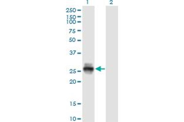 Kallikrein 4 anticorps  (AA 159-254)