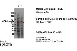 MCM8 WB Sample: siRNA Mock and siRNA MCM8 Dilution 1:1000 (MCM8 抗体  (N-Term))