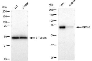 Western blotting analysis using PKC delta antibody (ABIN7799993). (Recombinant PKC delta 抗体)