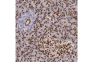 Immunohistochemical staining of human pancreas with PQBP1 polyclonal antibody  shows strong nuclear positivity in exocrine glandular cells and islet cells. (PQBP1 抗体)
