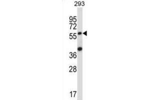 Western Blotting (WB) image for anti-Suppressor of Cytokine Signaling 6 (SOCS6) antibody (ABIN2997743) (SOCS6 抗体)