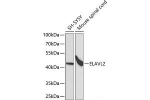 Western blot analysis of extracts of various cell lines using ELAVL2 Polyclonal Antibody at dilution of 1:1000. (ELAVL2 抗体)