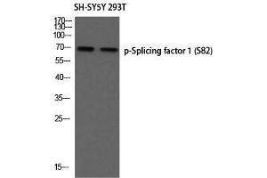 Western Blot (WB) analysis of SH-SY5Y 293T using p-Splicing factor 1 (S82) antibody. (Splicing Factor 1 抗体  (pSer82))