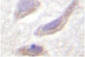 Image no. 1 for anti-Synuclein, alpha (SNCA) (pSer129) antibody (ABIN318305) (SNCA 抗体  (pSer129))