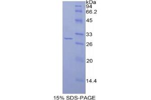 SDS-PAGE analysis of Rat IRAK2 Protein. (IRAK2 蛋白)