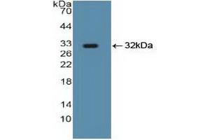 Western blot analysis of recombinant Human Smad5. (SMAD5 抗体  (AA 210-464))