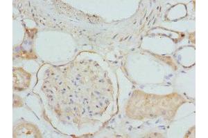Immunohistochemistry (IHC) image for anti-Electron-Transferring-Flavoprotein Dehydrogenase (ETFDH) (AA 318-617) antibody (ABIN7151501)