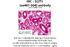 Image no. 2 for anti-Slit Homolog 1 (SLIT1) (AA 487-504) antibody (ABIN1739431) (SLIT1 抗体  (AA 487-504))