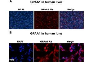 Immunofluorescent staining of human liver (A) and human lung (B) with GPAA1 polyclonal antibody  at 1:100 dilution. (GPAA1 抗体  (C-Term))