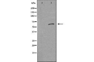 Western blot analysis of extracts from K562 cells using RANBP6 antibody. (RFTN1 抗体  (Internal Region))