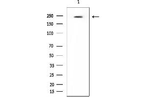 Western blot analysis of lysates from EC304 cells, using CACNA1C Mouse Monoclonal Antibody at 1/1000 dilution.